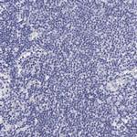 Cytokeratin 17 Antibody in Immunohistochemistry (Paraffin) (IHC (P))