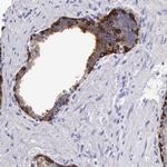 Cytokeratin 17 Antibody in Immunohistochemistry (Paraffin) (IHC (P))