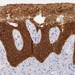 Cytokeratin 17 Antibody in Immunohistochemistry (Paraffin) (IHC (P))