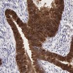 Apolipoprotein J Antibody in Immunohistochemistry (Paraffin) (IHC (P))