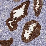 Apolipoprotein J Antibody in Immunohistochemistry (Paraffin) (IHC (P))