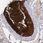 Apolipoprotein J Antibody in Immunohistochemistry (Paraffin) (IHC (P))