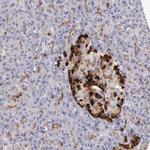 Apolipoprotein J Antibody in Immunohistochemistry (Paraffin) (IHC (P))