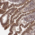 TRMU Antibody in Immunohistochemistry (Paraffin) (IHC (P))