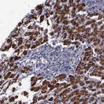 MLK1 Antibody in Immunohistochemistry (Paraffin) (IHC (P))