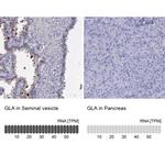 alpha Galactosidase Antibody in Immunohistochemistry (Paraffin) (IHC (P))