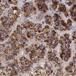 alpha Galactosidase Antibody in Immunohistochemistry (Paraffin) (IHC (P))