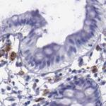 alpha Galactosidase Antibody in Immunohistochemistry (Paraffin) (IHC (P))