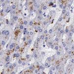 alpha Galactosidase Antibody in Immunohistochemistry (Paraffin) (IHC (P))