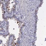 alpha Galactosidase Antibody in Immunohistochemistry (Paraffin) (IHC (P))