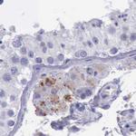 alpha Galactosidase Antibody in Immunohistochemistry (Paraffin) (IHC (P))