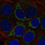 A4GALT Antibody in Immunocytochemistry (ICC/IF)