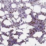 MMP9 Antibody in Immunohistochemistry (Paraffin) (IHC (P))