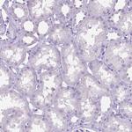 MMP9 Antibody in Immunohistochemistry (Paraffin) (IHC (P))