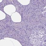 MMP9 Antibody in Immunohistochemistry (Paraffin) (IHC (P))