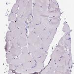 MMP9 Antibody in Immunohistochemistry (Paraffin) (IHC (P))