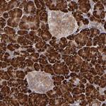 MTHFD1 Antibody in Immunohistochemistry (Paraffin) (IHC (P))