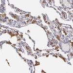 Syk Antibody in Immunohistochemistry (Paraffin) (IHC (P))