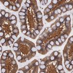 Syk Antibody in Immunohistochemistry (Paraffin) (IHC (P))