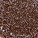 Syk Antibody in Immunohistochemistry (Paraffin) (IHC (P))