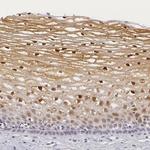 IL1RA Antibody in Immunohistochemistry (Paraffin) (IHC (P))