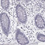 IL1RA Antibody in Immunohistochemistry (Paraffin) (IHC (P))