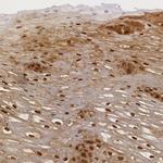 IL1RA Antibody in Immunohistochemistry (Paraffin) (IHC (P))