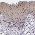 IL1RA Antibody in Immunohistochemistry (Paraffin) (IHC (P))