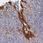 IL1RA Antibody in Immunohistochemistry (Paraffin) (IHC (P))