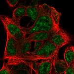 Ephrin B3 Antibody in Immunocytochemistry (ICC/IF)