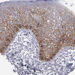 P-cadherin Antibody in Immunohistochemistry (Paraffin) (IHC (P))