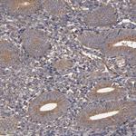 MMP2 Antibody in Immunohistochemistry (Paraffin) (IHC (P))