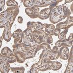 MMP2 Antibody in Immunohistochemistry (Paraffin) (IHC (P))