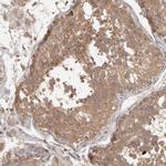 MMP2 Antibody in Immunohistochemistry (Paraffin) (IHC (P))