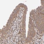 MMP2 Antibody in Immunohistochemistry (Paraffin) (IHC (P))