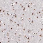 TRF2 Antibody in Immunohistochemistry (Paraffin) (IHC (P))