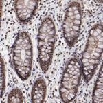 TRF2 Antibody in Immunohistochemistry (Paraffin) (IHC (P))