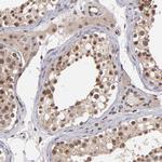 TRF2 Antibody in Immunohistochemistry (Paraffin) (IHC (P))