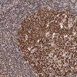 TRF2 Antibody in Immunohistochemistry (Paraffin) (IHC (P))