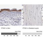 COX1 Antibody in Immunohistochemistry (Paraffin) (IHC (P))