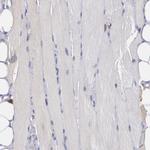 COX1 Antibody in Immunohistochemistry (Paraffin) (IHC (P))