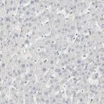 CUX1 Antibody in Immunohistochemistry (Paraffin) (IHC (P))