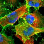 MCT1 Antibody in Immunocytochemistry (ICC/IF)