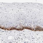 MCT1 Antibody in Immunohistochemistry (Paraffin) (IHC (P))