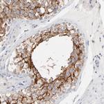 MCT1 Antibody in Immunohistochemistry (Paraffin) (IHC (P))