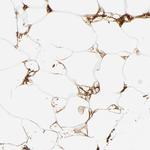 Complement C3 Antibody in Immunohistochemistry (Paraffin) (IHC (P))