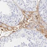 Complement C3 Antibody in Immunohistochemistry (Paraffin) (IHC (P))