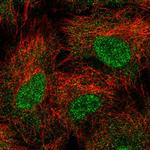 UBE2B Antibody in Immunocytochemistry (ICC/IF)