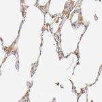 IL-18 Antibody in Immunohistochemistry (Paraffin) (IHC (P))