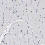 IL-18 Antibody in Immunohistochemistry (Paraffin) (IHC (P))